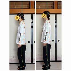 38歳女性・施術後の変化